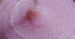 Gelcoat Repair